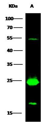 Western Blot: MESDC2 Antibody [NBP2-99668]