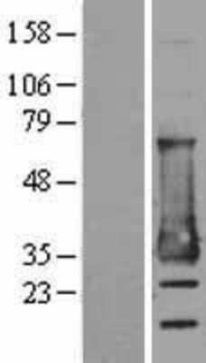 Western Blot: MESDC2 Overexpression Lysate [NBL1-13014]