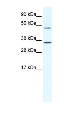 Western Blot: MESP2 Antibody [NBP1-80219]