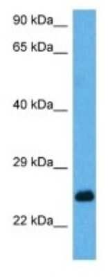 Western Blot: MESP2 Antibody [NBP3-10989]