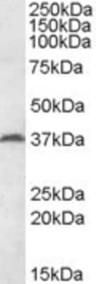 Western Blot: MEST Antibody [NBP1-44050]