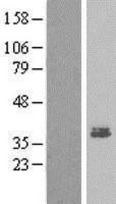 Western Blot: MEST Overexpression Lysate [NBP2-10035]