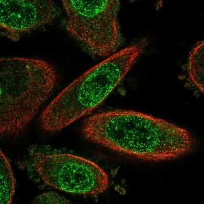 Immunocytochemistry/ Immunofluorescence: Meteorin Antibody [NBP2-14231]