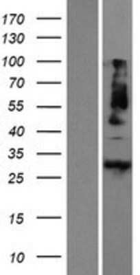 Western Blot: Meteorin Overexpression Lysate [NBP2-06365]