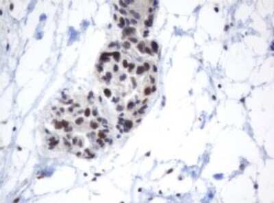 Immunohistochemistry: METT10D Antibody (OTI3E8) [NBP2-45823]