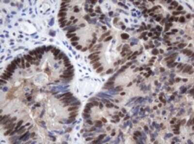 Immunohistochemistry: METT10D Antibody (OTI3E8) [NBP2-45823]