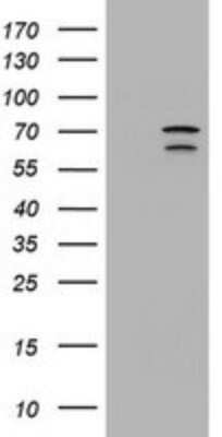 Western Blot: METT10D Antibody (OTI3E8) [NBP2-45823]