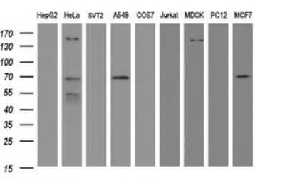 Western Blot: METT10D Antibody (OTI3E8) [NBP2-45823]