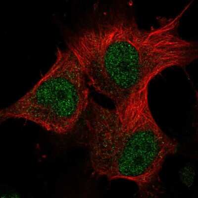 Immunocytochemistry/ Immunofluorescence: METT10D Antibody [NBP2-56696]