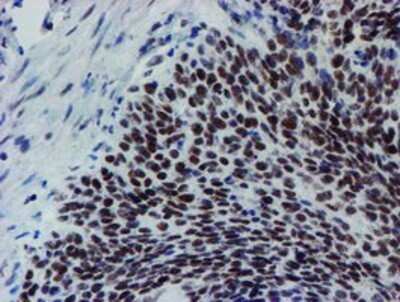 Immunohistochemistry: METT10D Antibody (OTI3B5) - Azide and BSA Free [NBP2-72654]