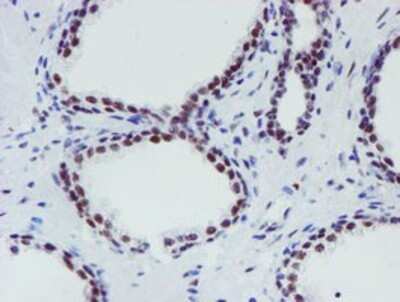 Immunohistochemistry: METT10D Antibody (OTI3B5) - Azide and BSA Free [NBP2-72654]