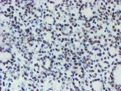 Immunohistochemistry: METT10D Antibody (OTI3B5) - Azide and BSA Free [NBP2-72654]