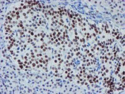Immunohistochemistry: METT10D Antibody (OTI3B5) - Azide and BSA Free [NBP2-72654]