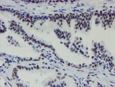Immunohistochemistry: METT10D Antibody (OTI3B5) - Azide and BSA Free [NBP2-72654]