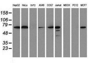 Western Blot: METT10D Antibody (OTI3B5)Azide and BSA Free [NBP2-72654]