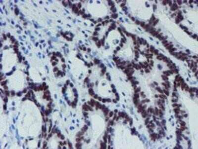 Immunohistochemistry-Paraffin: METT10D Antibody (OTI3B5) [NBP2-02026]