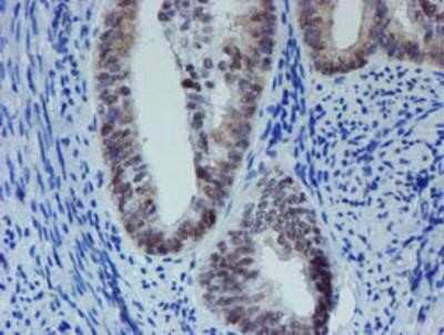 Immunohistochemistry-Paraffin: METT10D Antibody (OTI3B5) [NBP2-02026]