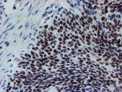 Immunohistochemistry-Paraffin: METT10D Antibody (OTI3B5) [NBP2-02026]