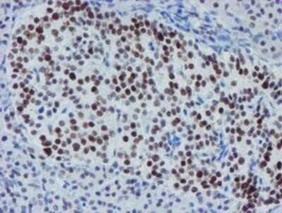 Immunohistochemistry-Paraffin: METT10D Antibody (OTI3B5) [NBP2-02026]