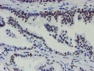 Immunohistochemistry-Paraffin: METT10D Antibody (OTI3B5) [NBP2-02026]