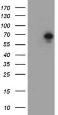 Western Blot: METT10D Antibody (OTI3B5) [NBP2-02026]