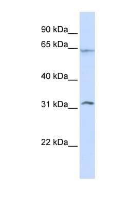 Western Blot: METT10D Antibody [NBP1-79256]