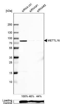 Western Blot: METT10D Antibody [NBP1-81239]