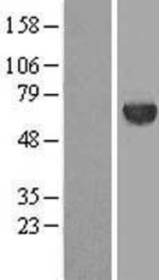 Western Blot: METT10D Overexpression Lysate [NBL1-13020]