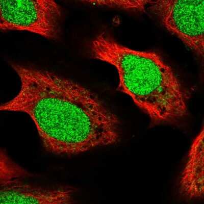 Immunocytochemistry/ Immunofluorescence: METT11D1 Antibody [NBP2-54746]