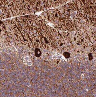 Immunohistochemistry-Paraffin: METT11D1 Antibody [NBP2-54746]