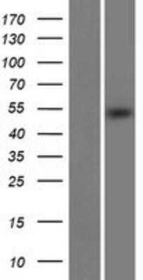 Western Blot: METT11D1 Overexpression Lysate [NBP2-11609]