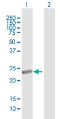 Western Blot: METT5D1 Antibody [H00196074-B01P]