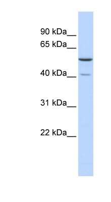 Western Blot: METT5D1 Antibody [NBP1-55023]