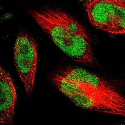 Immunocytochemistry/ Immunofluorescence: METTL1 Antibody [NBP1-88386]