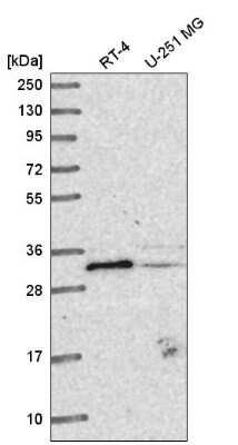 Western Blot: METTL1 Antibody [NBP2-58787]