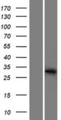 Western Blot: METTL1 Overexpression Lysate [NBP2-07758]