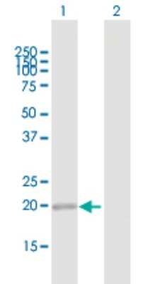 Western Blot: METTL10 Antibody [H00399818-B01P]
