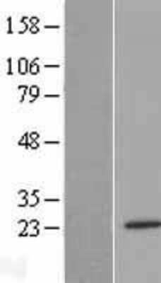 Western Blot: METTL10 Overexpression Lysate [NBP2-04473]