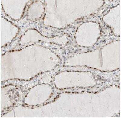 Immunohistochemistry-Paraffin: METTL11B Antibody [NBP1-88494]