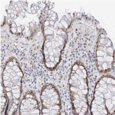Immunohistochemistry-Paraffin: METTL11B Antibody [NBP1-88494]