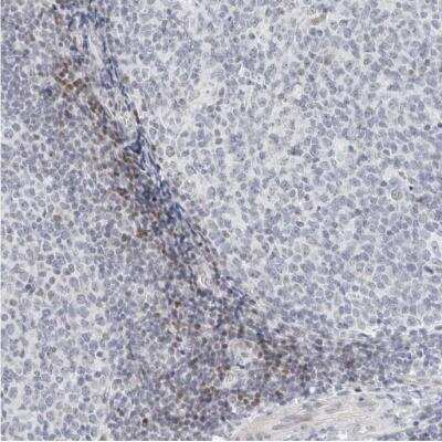 Immunohistochemistry-Paraffin: METTL11B Antibody [NBP1-88494]