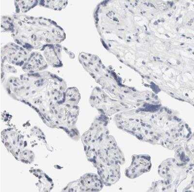 Immunohistochemistry-Paraffin: METTL11B Antibody [NBP1-88494]