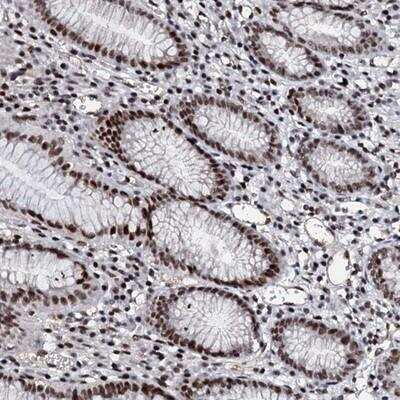 Immunohistochemistry: METTL12 Antibody [NBP1-90991]