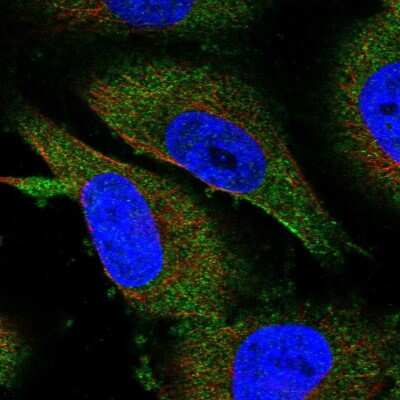 Immunocytochemistry/ Immunofluorescence: METTL13 Antibody [NBP1-92109]