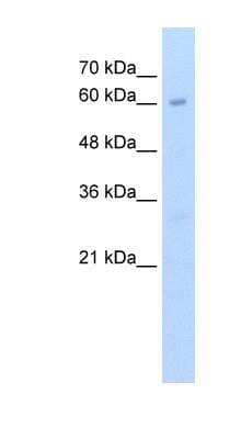 Western Blot: METTL13 Antibody [NBP1-55484]