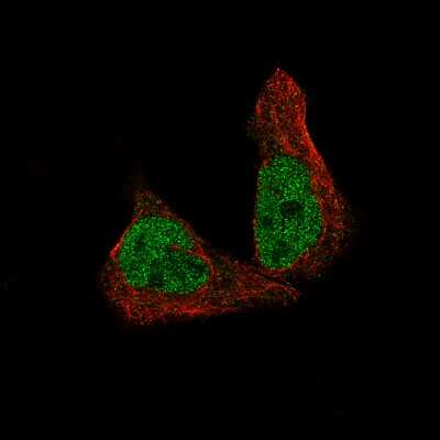 Immunocytochemistry/ Immunofluorescence: METTL14 Antibody (CL4252) [NBP2-59043]