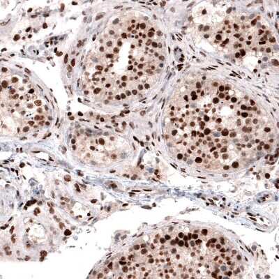 Immunohistochemistry-Paraffin: METTL14 Antibody (CL4252) [NBP2-59043]