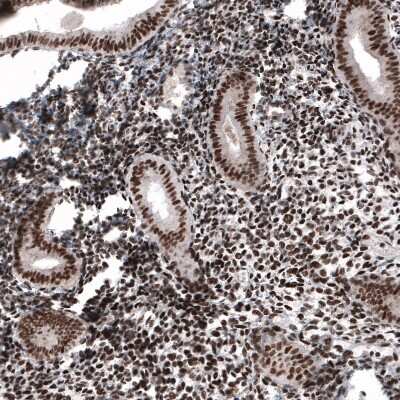 Immunohistochemistry-Paraffin: METTL14 Antibody (CL4252) [NBP2-59043]