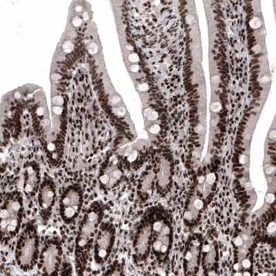 Immunohistochemistry-Paraffin: METTL14 Antibody (CL4252) [NBP2-59043]
