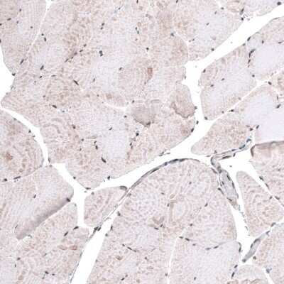 Immunohistochemistry-Paraffin: METTL14 Antibody (CL4252) [NBP2-59043]